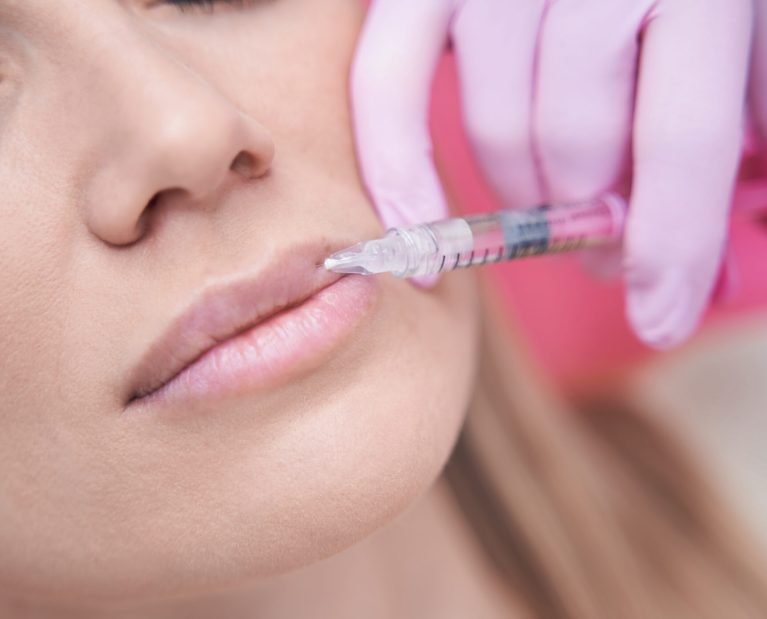 Closeup of tranquil female patient getting injection into her upper lip performed by dermatologist